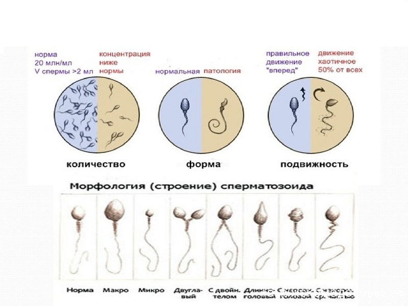 Азооспермия - лечение и диагностика, причины, симптомы | Клиника «Геном» в Волгограде